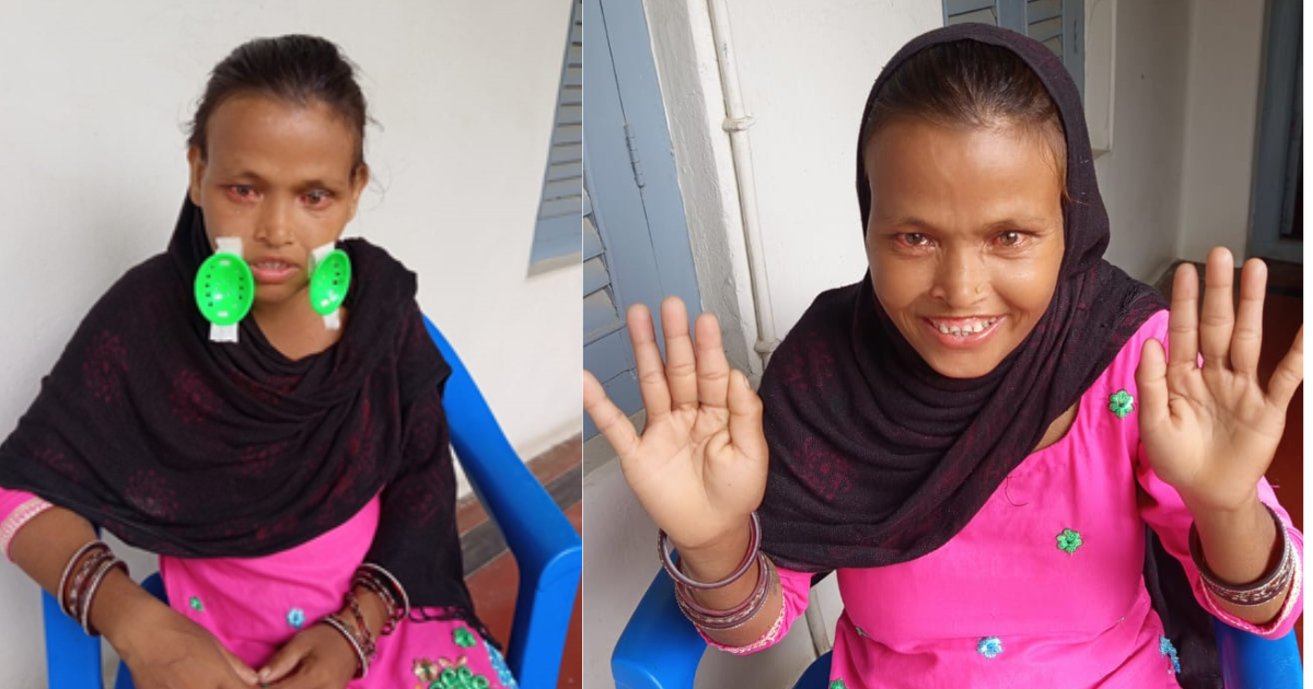 आँखाको ज्योति फर्किएपछि चन्द्रावतीले भनिन्, ‘अब  संसारसँग छामेर होइन, हेरेर  आफैँ जुध्न सक्छु’