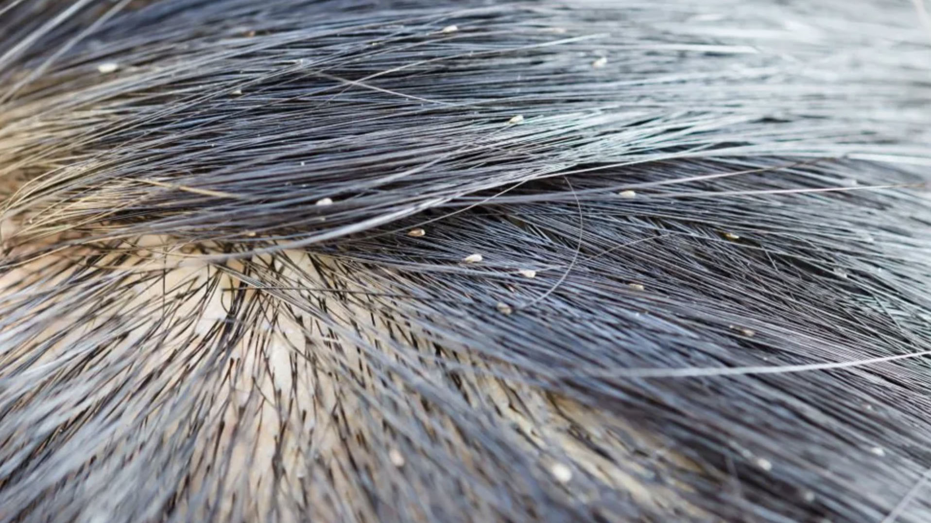 उहिले जुम्रा, उडुस र उपियाँ